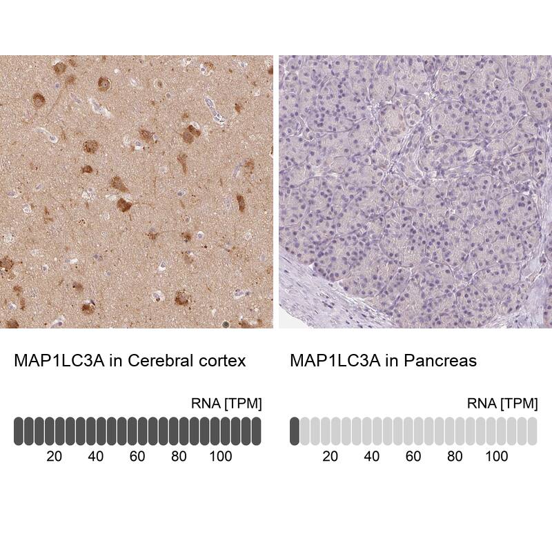 <b>Orthogonal Strategies Validation. </b>Analysis in human cerebral cortex and pancreas tissues.