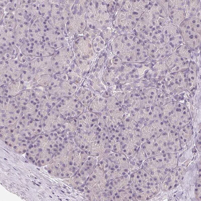 Staining of human pancreas shows low expression as expected.