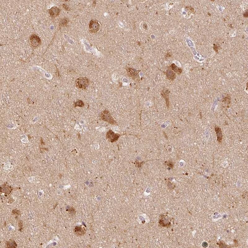 Staining of human cerebral cortex shows high expression.