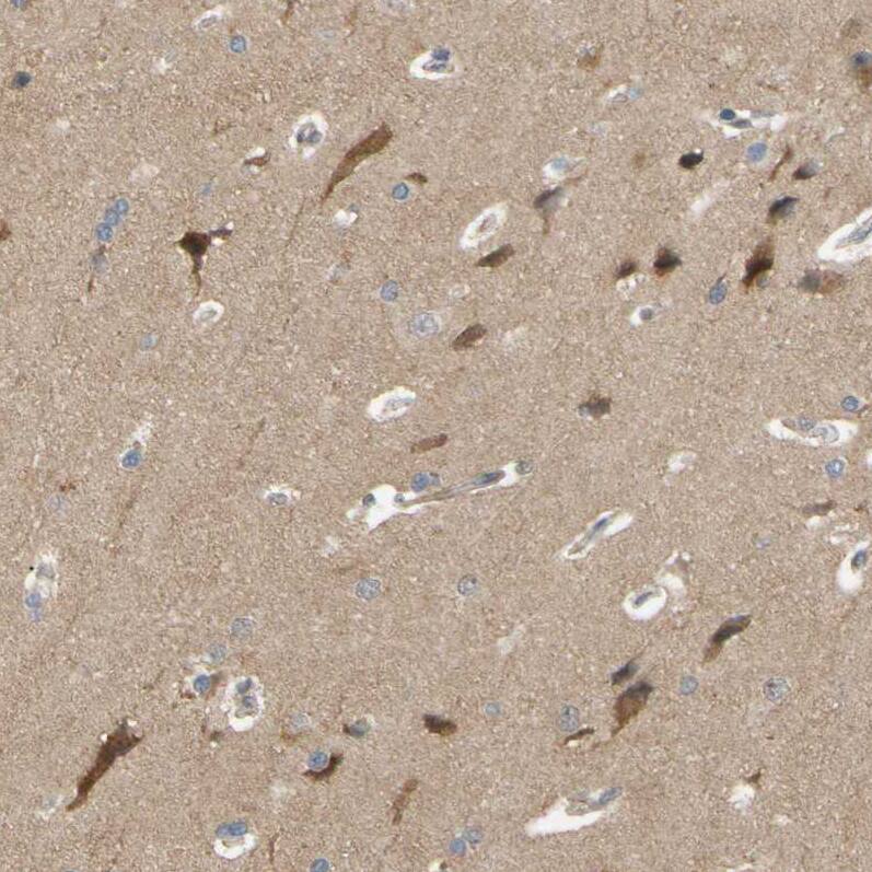 Staining of human cerebral cortex shows cytoplasmic positivity in neurons.
