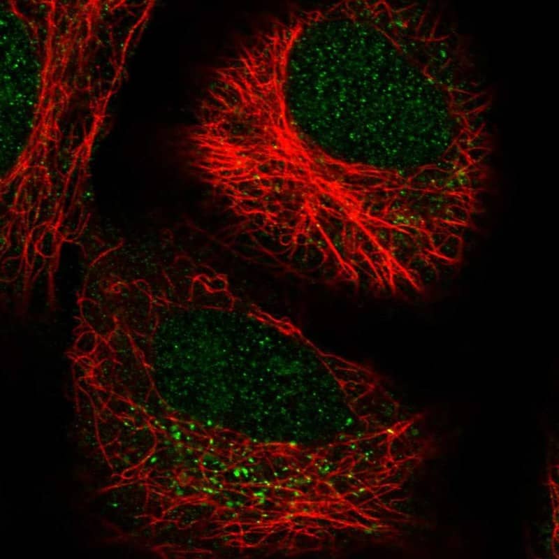 Staining of human cell line A549 shows localization to nucleus & vesicles.
