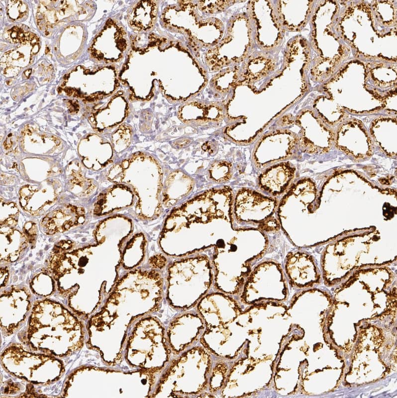 Staining of human lactating breast shows strong positivity in glandular cells.