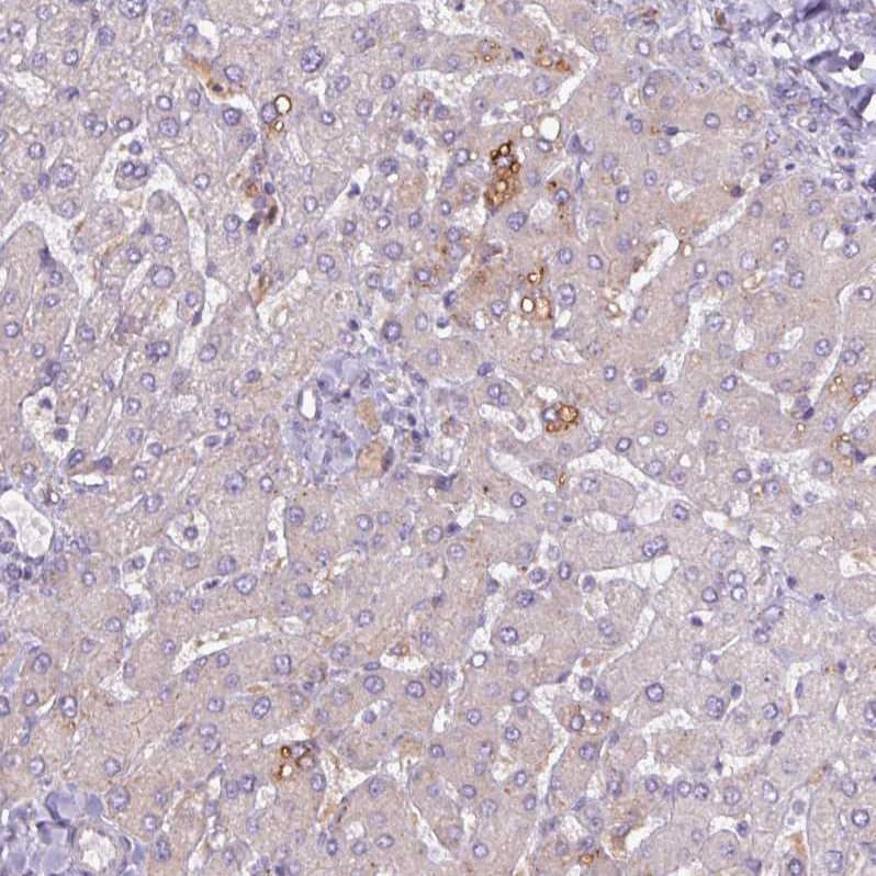 Staining of human liver shows moderate cytoplasmic positivity in hepatocytes.