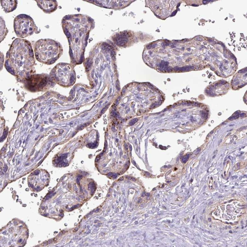 Staining of human placenta shows moderate granular cytoplasmic positivity in trophoblastic cells.
