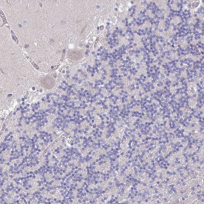 Staining of human cerebellum shows no positivity in neurons as expected.