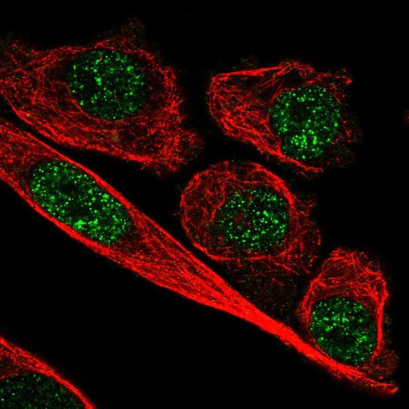 Staining of human cell line PC-3 shows localization to nucleoplasm.