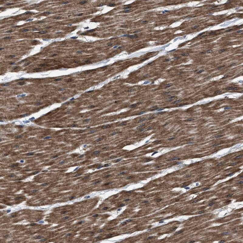 <b>Independent Antibodies Validation. </b>Staining of human smooth muscle shows distinct cytoplasmic positivity in smooth muscle cells.