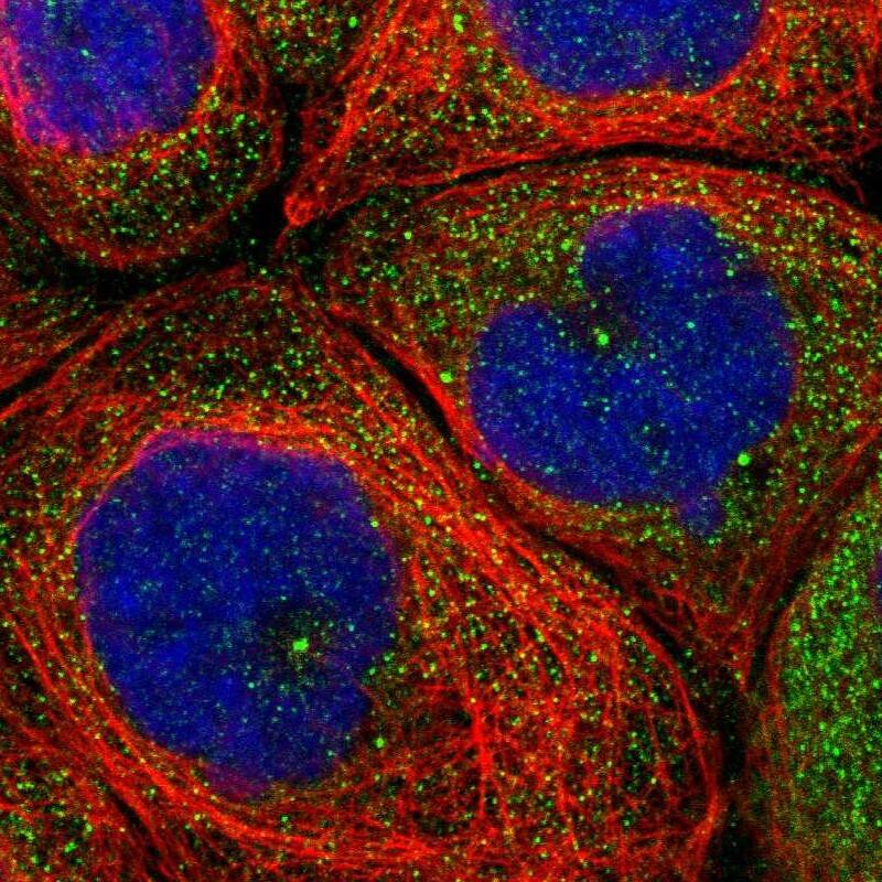 Staining of human cell line A-431 shows localization to cytosol & centrosome.