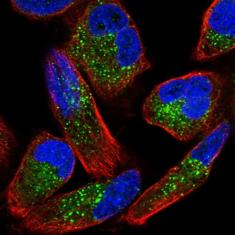 Staining of human cell line RH-30 shows localization to vesicles.