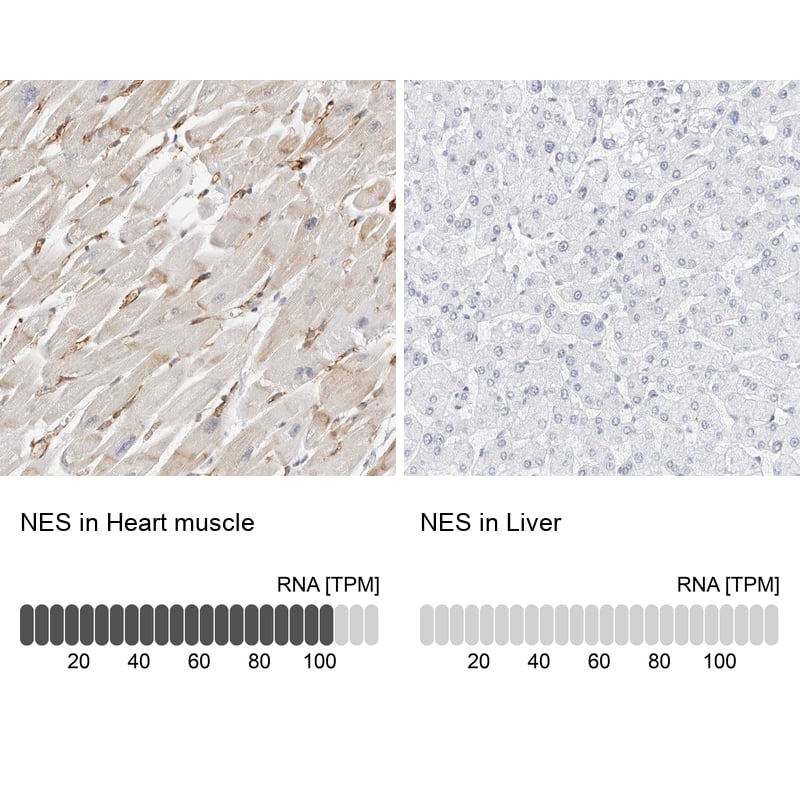 <b>Orthogonal Strategies Validation. </b>Analysis in human heart muscle and liver tissues. Corresponding RNA-seq data are presented for the same tissues.
