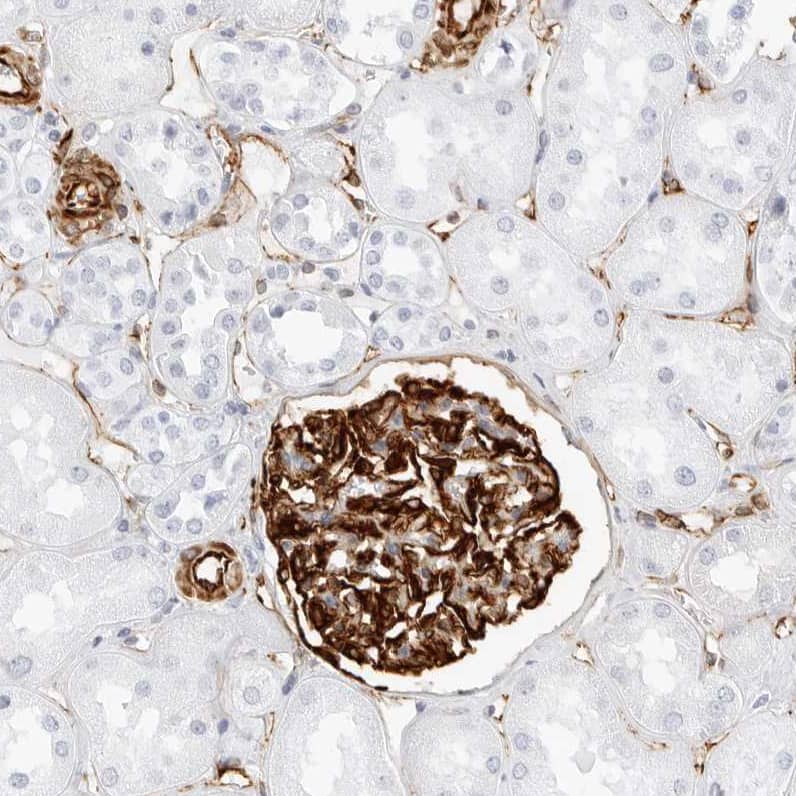 Staining of human kidney shows strong cytoplasmic positivity in cells in glomeruli.