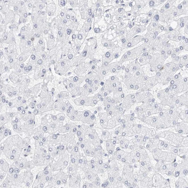 Staining of human liver shows negative cytoplasmic positivity in hepatocytes as expected.