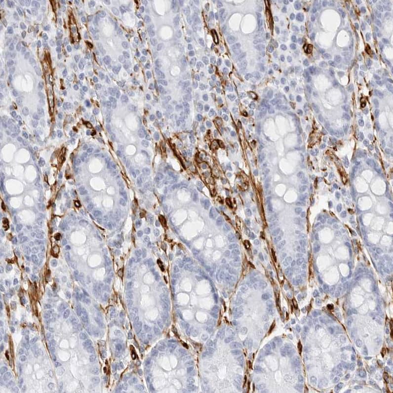 Staining of human duodenum shows strong cytoplasmic positivity in endothelial cells.