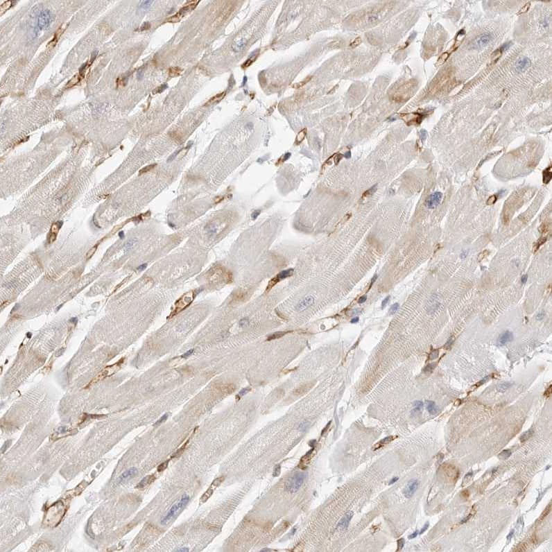 Staining of human heart muscle shows strong cytoplasmic positivity in cardiomyocytes.