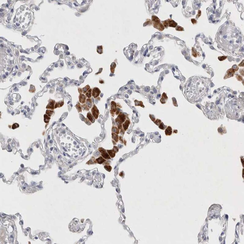 Staining of human lung shows strong granular cytoplasmic positivity in macrophages.