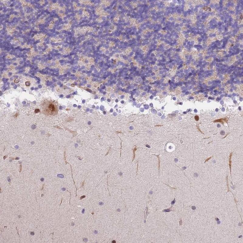 Immunohistochemistry-Paraffin S100P binding protein Antibody - BSA Free