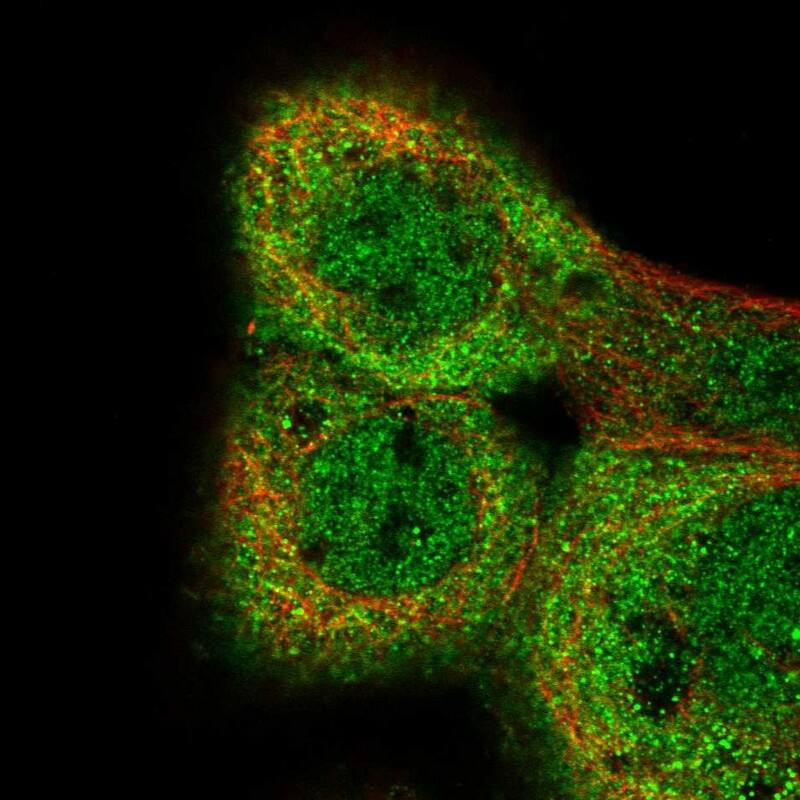 Staining of human cell line A-431 shows localization to nucleoplasm & cytosol.