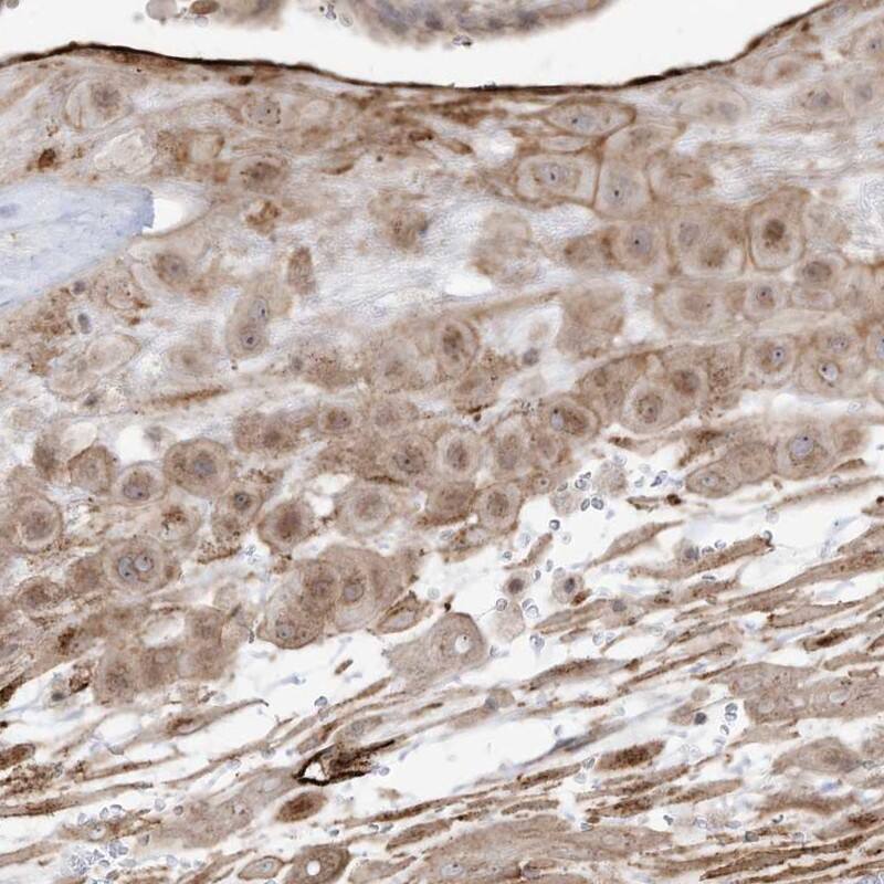 Immunohistochemistry-Paraffin ZGRF1 Antibody - BSA Free