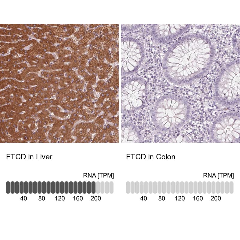 <b>Orthogonal Strategies Validation. </b>Analysis in human liver and colon tissues. Corresponding RNA-seq data are presented for the same tissues.