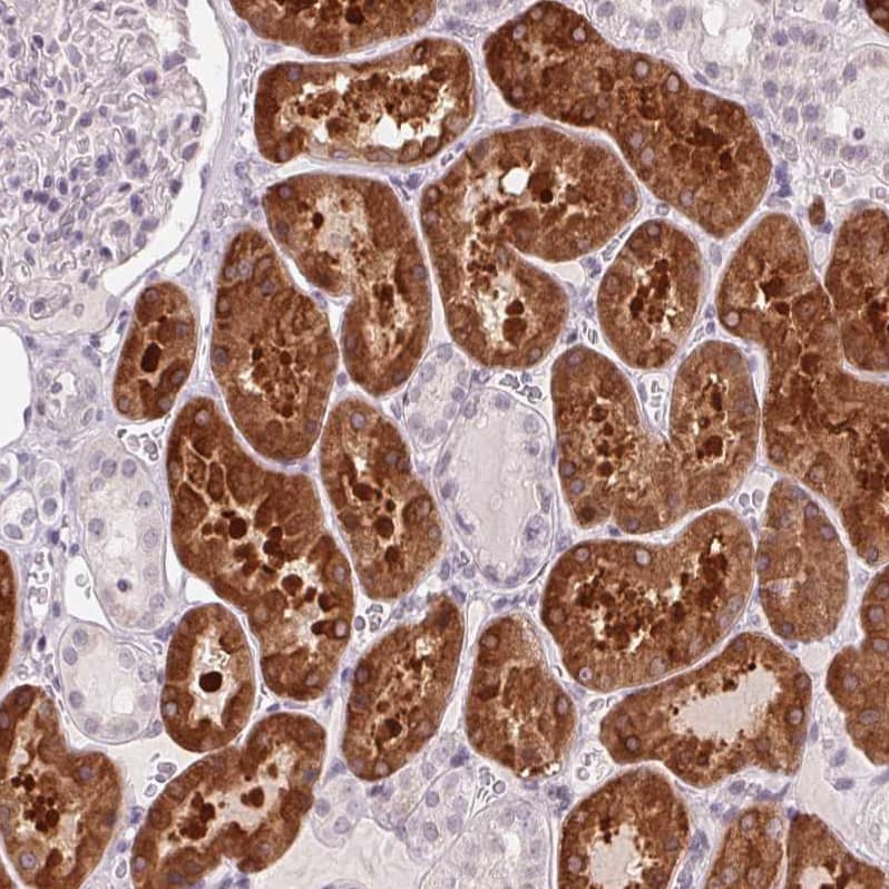 Staining of human kidney shows strong cytoplasmic positivity in cells in tubules.