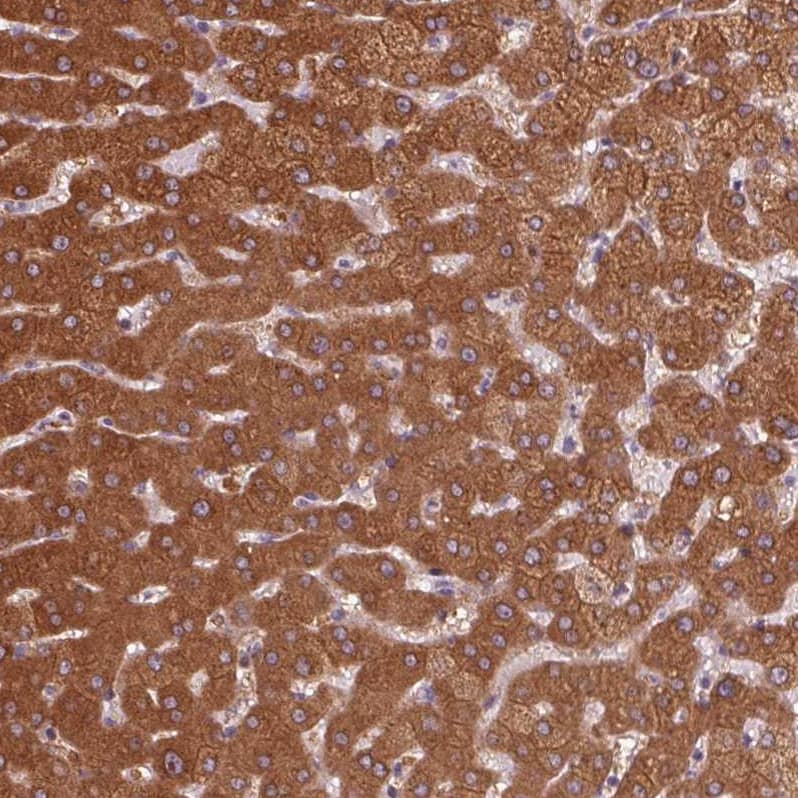 Staining of human liver shows strong cytoplasmic positivity in hepatocytes.
