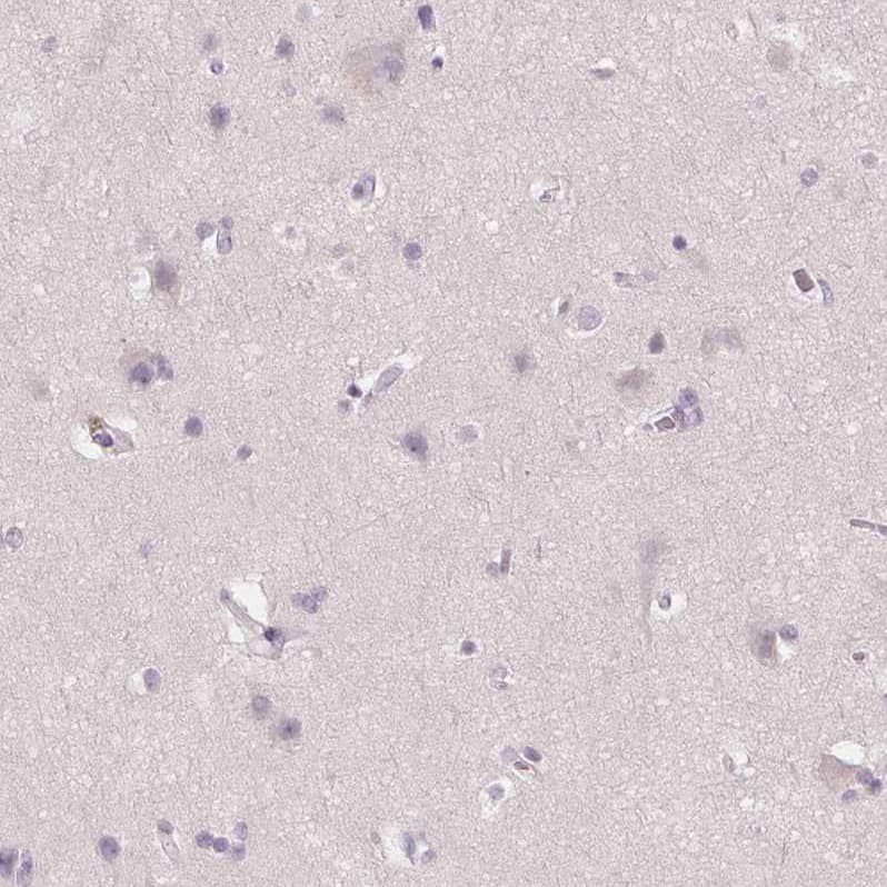 Staining of human cerebral cortex shows no cytoplasmic positivity in neuronal cells as expected.