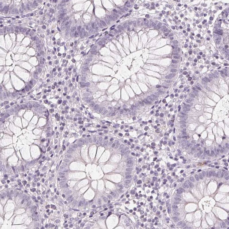 Staining of human colon shows no cytoplasmic positivity in glandular cells as expected.