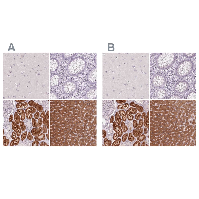 <b>Orthogonal Strategies Validation. </b>Staining of human cerebral cortex, colon, kidney and liver HPA030929 (A) shows similar protein distribution across tissues to independent antibody HPA030928 (B).