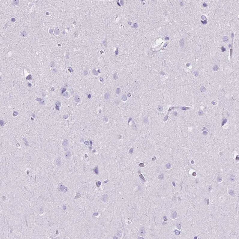 Staining of human cerebral cortex shows no positivity in neurons as expected.