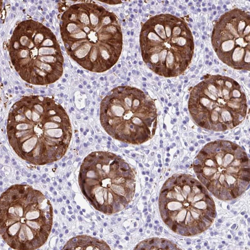 Staining of human colon shows strong cytoplasmic positivity in glandular cells.