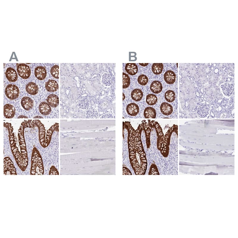 Staining of human colon, kidney, rectum and skeletal muscle .