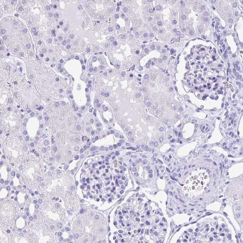 Staining of human kidney shows no positivity in cells in tubules as expected.