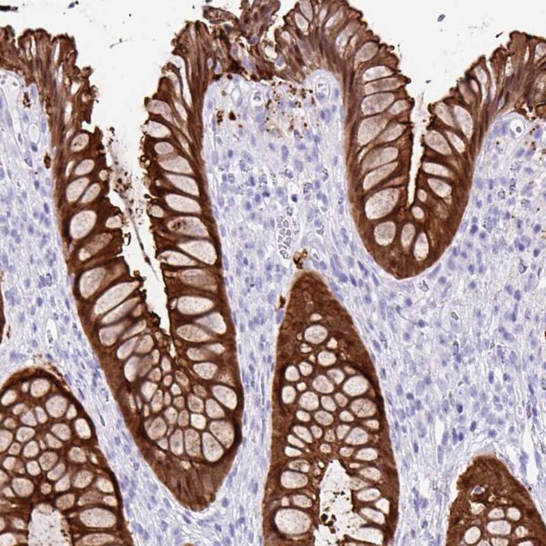 Staining of human rectum shows strong cytoplasmic positivity in glandular cells.