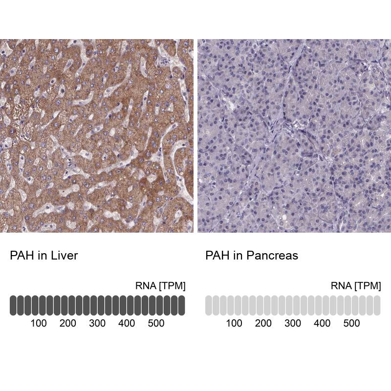 <b>Orthogonal Strategies Validation. </b>Analysis in human liver and pancreas tissues. Corresponding RNA-seq data are presented for the same tissues.