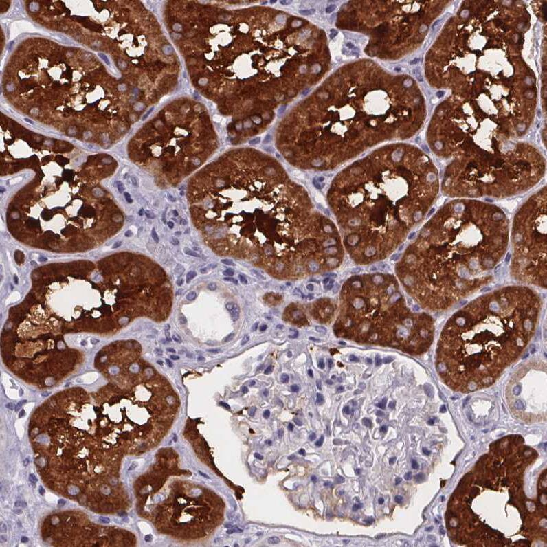 Staining of human kidney shows strong cytoplasmic positivity in cells in proximal tubules.