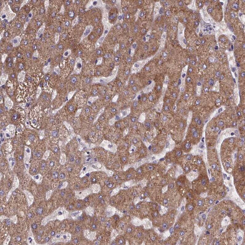 Staining of human liver shows moderate to strong cytoplasmic positivity in hepatocytes.