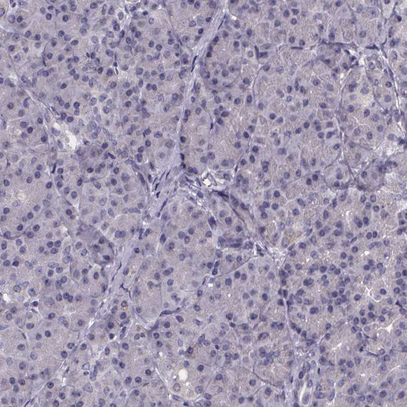 Staining of human pancreas shows no positivity in exocrine glandular cells as expected.