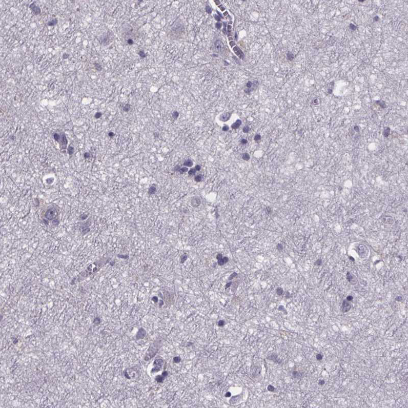 Staining of human cerebral cortex shows no positivity in neurons as expected.