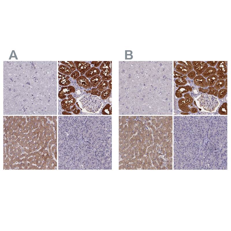 <b>Orthogonal Strategies Validation. </b>Staining of human cerebral cortex, kidney, liver and pancreas HPA031642 (A) shows similar protein distribution across tissues to independent antibody HPA028407 (B).