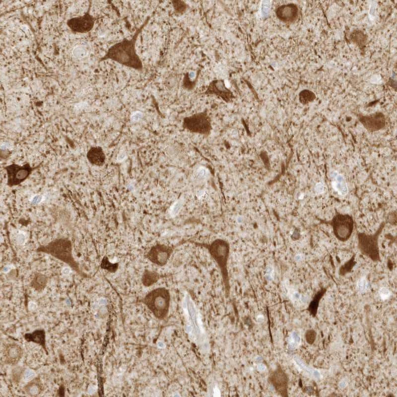 Staining of human cerebral cortex shows strong cytoplasmic positivity in glial cells.