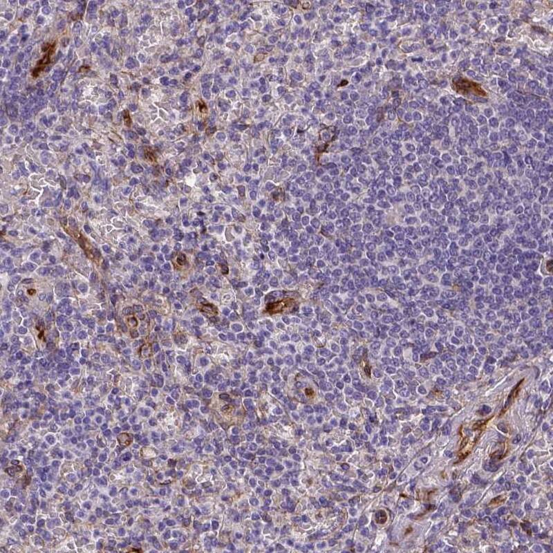 Staining of human spleen shows strong cytoplasmic positivity in blood vessels.