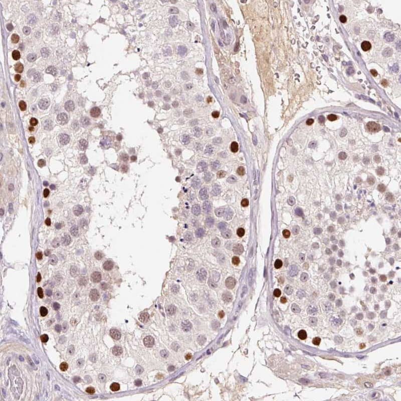 Staining of human testis shows nuclear positivity in seminiferous ducts.