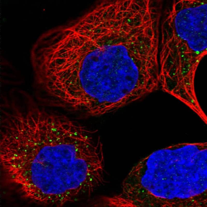 Staining of human cell line A-431 shows localization to vesicles.