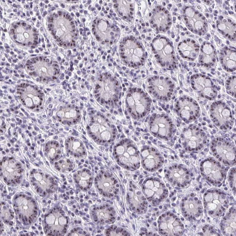 Immunohistochemistry-Paraffin NIFK Antibody - BSA Free