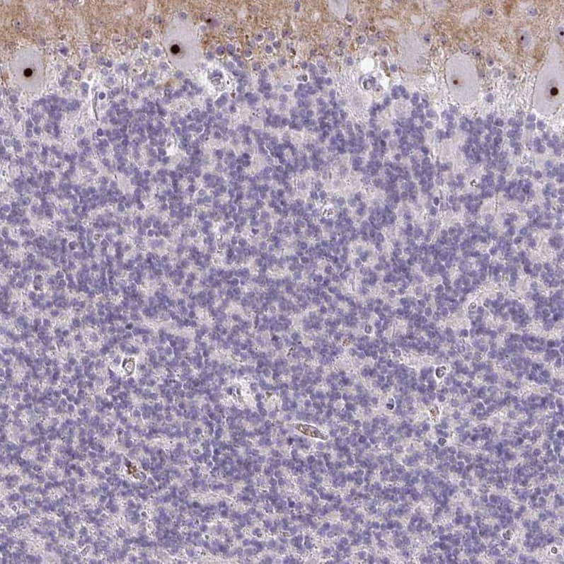 Immunohistochemistry-Paraffin NIFK Antibody - BSA Free