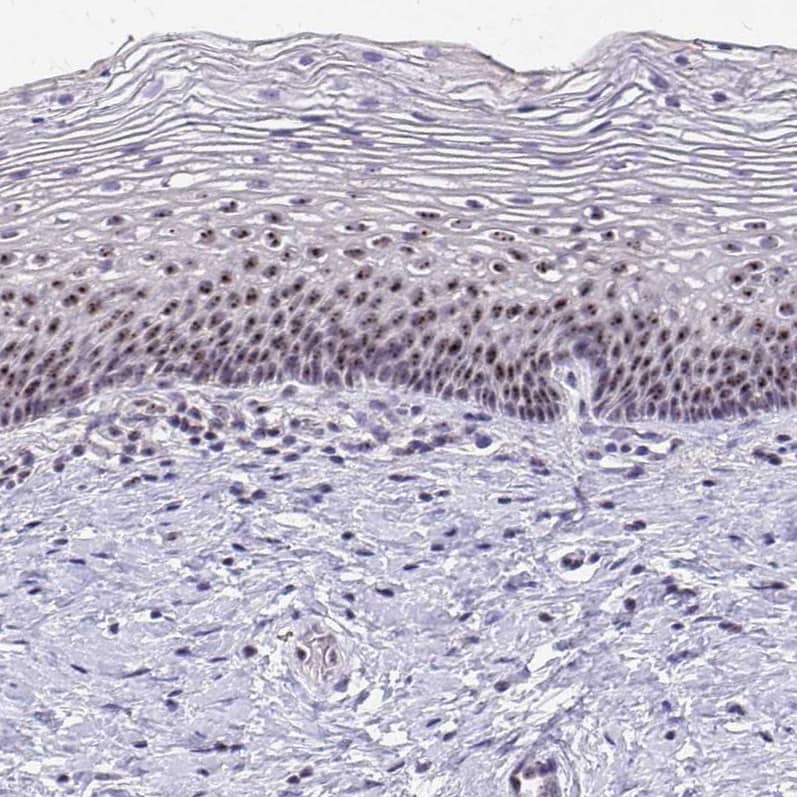 Immunohistochemistry-Paraffin NIFK Antibody - BSA Free