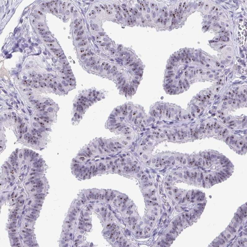 Immunohistochemistry-Paraffin NIFK Antibody - BSA Free