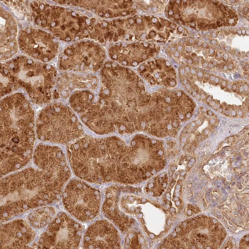 Staining of human kidney shows strong cytoplasmic positivity in cells in tubules.