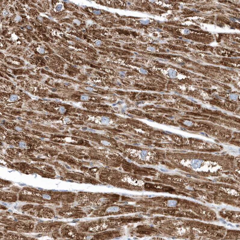 Staining of human heart muscle shows strong cytoplasmic granular positivity in cardiomyocytes.