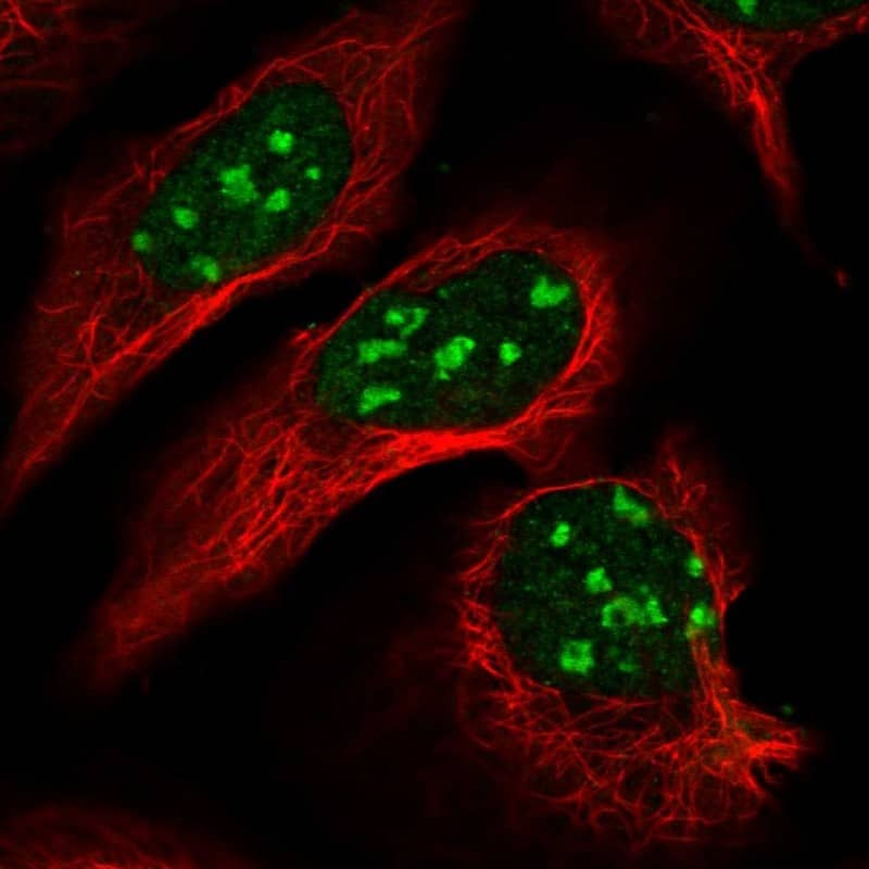 Staining of human cell line U-2 OS shows localization to nucleus & nucleoli.